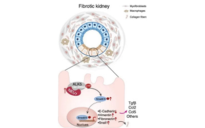 小分子、多肽、蛋白一网打尽，看Biacore在肾病药物研究中大显身手